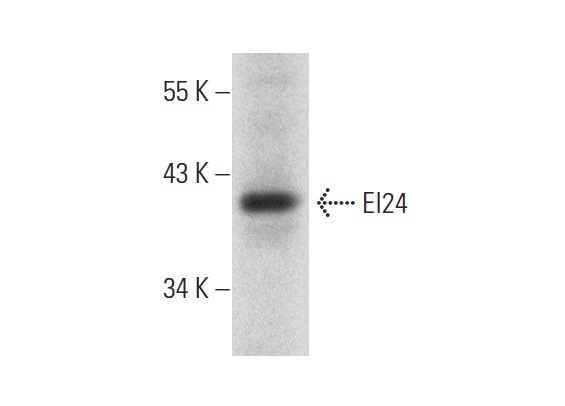  EI24 (H-101): sc-292270. Western blot analysis of EI24 expression in mouse liver tissue extract.