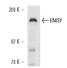  EMSY (A-15): sc-34995. Western blot analysis of EMSY expression in HeLa whole cell lysate.