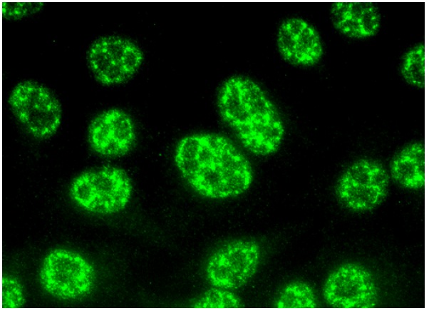  API5 (D-1): sc-393341. Immunofluorescence staining of methanol-fixed HeLa cells showing nuclear localization.