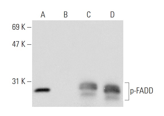  Western blot analysis of FADD phosphorylation in untreated (A,C) and treated (B,D) A-431 whole cell lysates. Antibodies tested include p-FADD (Ser 194): sc-12439 (A,B) and FADD (H-181): sc-5559 (C,D).