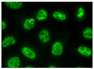  API5 (E-12): sc374528. Immunofluorescence staining of methanol-fixed HeLa cells showing nuclear localization.