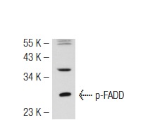  p-FADD (Ser 191): sc-33399. Western blot analysis of FADD phosphorylation in SW480 whole cell lysate.