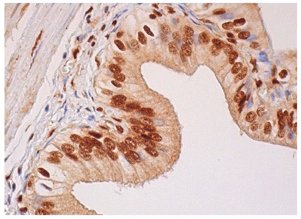  p-FADD (Ser 194): sc-12439. Immunoperoxidase staining of formalin fixed, paraffin-embedded human gall bladder tissue showing nuclear staining of glandular cells.