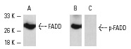  Western blot detection of FADD phosphorylation using A-431 cells. Blots were probed with FADD (H-181): sc-5559 (A) and p-FADD (Ser 194)-R: sc-12439-R (B,C). In B and C, the antibody was preincubated with cognate non-phosphorylated or phosphorylated peptide, respectively.