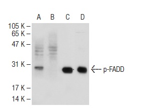  Western blot analysis of FADD phosphorylation in untreated (A,C), and lambda protein phosphatase treated (B,D) A-431 whole cell lysates. Antibodies tested include p-FADD (Ser 194): sc-12439 (A,B) and FADD (FD19): sc-56093 (B,D).