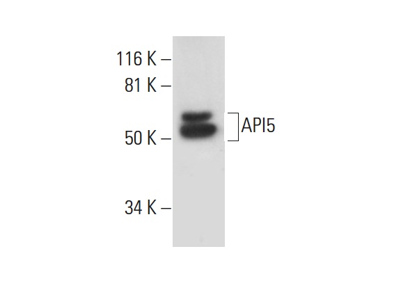  API5 (E-12): sc-374528. Western blot analysis of API5 expression in Y79 nuclear extract.