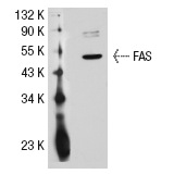  FAS (A-20): sc-1023. Western blot analysis of FAS expression in Jurkat whole cell lysate.