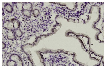  API5 (Z-18): sc-101203. Immunoperoxidase staining of formalin-fixed, paraffin-embedded human small Intestine tissue showing nuclear localization.