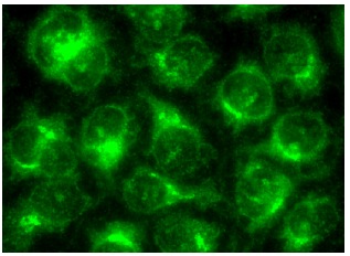  FAS (X-20): sc-1024. Immunofluorescence staining of methanol-fixed HeLa cells showing cytoplasmic localization.