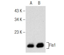  Fis1 (B-5): sc-376447. Western blot analysis of Fis1 expression in A-431 (A) and HeLa (B) whole cell lysates.