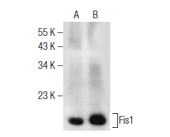  Fis1 (D-9): sc-376446. Western blot analysis of Fis1 expression in A-431 (A) and HeLa (B) whole cell lysates.