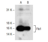  Fis1 (FL-152): sc-98900. Western blot analysis of Fis1 expression in A-431 (A) and HeLa (B) whole cell lysates.