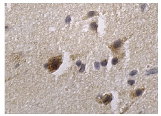  Fis1 (FL-152): sc-98900. Immunoperoxidase staining of formalin fixed, paraffin-embedded human brain tissue showing cytoplasmic staining of neuronal cells.