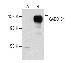  GADD 34 (B-10): sc-373815. Western blot analysis of GADD 34 expression in non-transfected: sc-117752 (A) and human GADD 34 transfected: sc-174859 (B) 293T whole cell lysates.