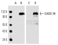  Western blot analysis of control (A,C) and GADD 34 transfected (B,D) COS cells. Antibodies tested include GADD 34 (D-8): sc-46661 (A,B) and GADD 34 (H-193): sc-8327 (C,D).