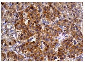  GADD 34 (H-193): sc-8327. Immunoperoxidase staining of formalin fixed, paraffin-embedded human pancreas tissue showing cytoplasmic staining of Islets of Langerhans and glandular cells.