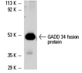  GADD 34 (S-20): sc-824. Western blot analysis of human recombinant GADD34 fusion protein.