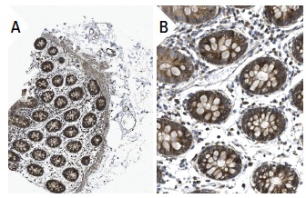  GADD 34 (S-20): sc-824. Immunoperoxidase staining of formalin fixed, paraffin-embedded human colon tissue showing cytoplasmic staining of glandular cells (low and high magnification). Kindly provided by The Swedish Human Protein Atlas (HPA) program.