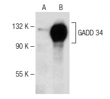  GADD 34 (S-20): sc-824. Western blot analysis of GADD 34 expression in non-transfected: sc-117752 (A) and human GADD 34 transfected: sc-174859 (B) 293T whole cell lysates.