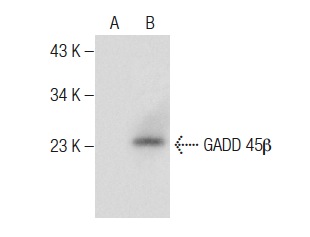  GADD 45β (G-11): sc-377311. Western blot analysis of GADD 45β expression in non-transfected (A) and human GADD 45β transfected (B) CMV whole cell lysates.