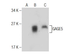  GAGE12H (K-17): sc-323903. Western blot analysis of GAGE5 expression in non-transfected 293T: sc-117752 (A), human GAGE5 transfected 293T: sc-113746 (B) and LNCaP (C) whole cell lysates.