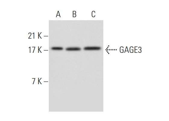  GAGE3 (N-10): sc-138012. Western blot analysis of GAGE3 expression in HeLa (A), Jurkat (B) and K-562 (C) whole cell lysates.