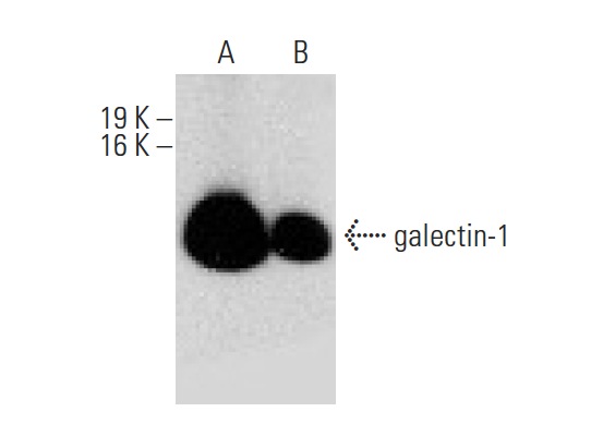  galectin-1 (D-1): sc-271819. Western blot analysis of galectin-1 expression in NIH/3T3 (A) and KNRK (B) whole cell lysates.