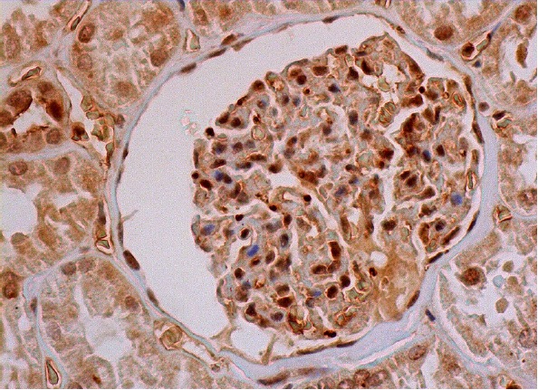  galectin-1 (K-20): sc-19279. Immunoperoxidase stain-ing of formalin fixed, paraffin-embedded human kidney tissue showing nuclear and cytoplasmic staining of cells in glomeruli and cells in tubules.