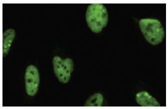  APNG (3D1): sc-101237. Immunofluorescence staining of paraformaldehyde-fixed HeLa cells showing nuclear localization.