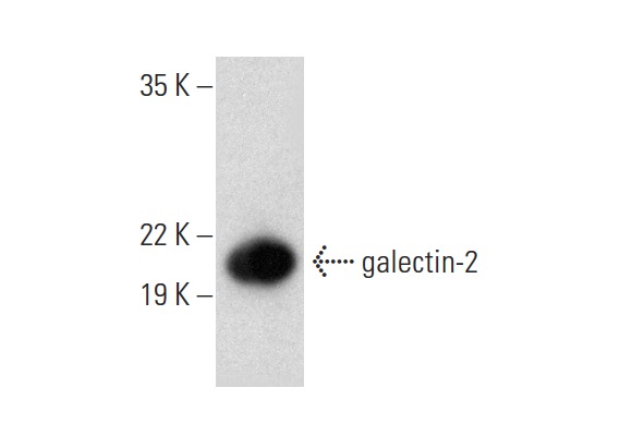  galectin-2 (M-45): sc-28250. Western blot analysis of galectin-2 expression in mouse small intestine tissue extract.