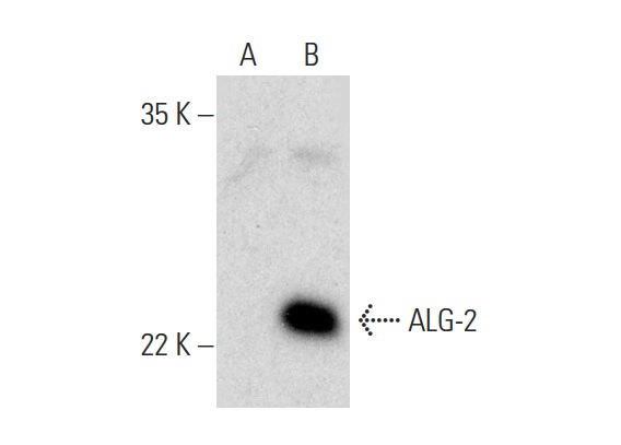  ALG-2 (FL-191): sc-292580. Western blot analysis of ALG-2 expression in non-transfected: sc-117752 (A) and human ALG-2 transfected: sc-112988 (B) 293T whole cell lysates.