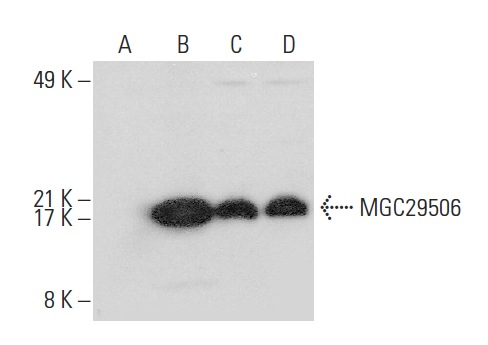  2010001M09Rik (V-14): sc-166994. Western blot analysis of MGC29506 expression in non-transfected 293T: sc-117752 (A), human MGC29506 transfected 293T: sc-175812 (B), Raji (C) and MOLT-4 (D) whole cell lysates.