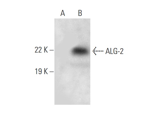  ALG-2 (FL-191): sc-292580. Western blot analysis of ALG-2 expression in non-transfected: sc-117752 (A) and human ALG-2 transfected: sc-114742 (B) 293T whole cell lysates.