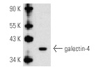  galectin-4 (Q-20): sc-19289. Western blot analysis of galectin-4 expression in rat cerebellum tissue extract.