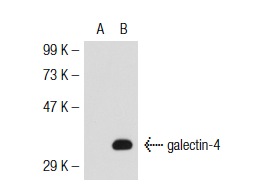  galectin-4 (Q-20): sc-19289. Western blot analysis of galectin-4 expression in non-transfected: sc-117752 (A) and mouse galectin-4 transfected: sc-126885 (B) 293T whole cell lysates.