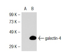  galectin-4 (G-20): sc-19288. Western blot analysis of galectin-4 expression in non-transfected: sc-117752 (A) and mouse galectin-4 transfected: sc-126885 (B) 293T whole cell lysates.