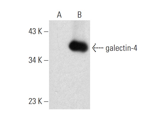  galectin-4 (E-2): sc-271209. Western blot analysis of galectin-4 expression in non-transfected: sc-117752 (A) and mouse galectin-4 transfected: sc-126885 (B) 293T whole cell lysates.