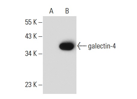  galectin-4 (B-9): sc-271533. Western blot analysis of galectin-4 expression in non-transfected: sc-117752 (A) and mouse galectin-4 transfected: sc-126885 (B) 293T whole cell lysates.