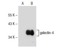  galectin-4 (C-6): sc-376263. Western blot analysis of galectin-4 expression in non-transfected: sc-117752 (A) and mouse galectin-4 transfected: sc-126885 (B) 293T whole cell lysates.