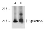  galectin-5 (F-11): sc-48358. Western blot analysis of galectin-5 expression in rat peripheral blood (A) and rat liver tissue (B) extracts.