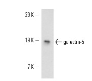  galectin-5 (R-19): sc-31801. Western blot analysis of galectin-5 expression in rat PBL whole cell lysate.