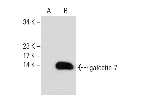  galectin-7 (H-8): sc-166222. Western blot analysis of galectin-7 expression in non-transfected: sc-117752 (A) and human galectin-7 transfected: sc-117240 (B) 293T whole cell lysates.