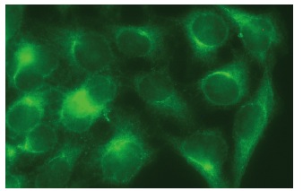  galectin-7 (H-8): sc-166222. Immunofluorescence staining of methanol-fixed HeLa cells showing cytoplasmic localization.