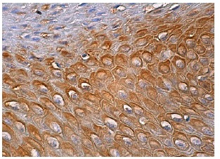  galectin-7 (H-8): sc-166222. Immunoperoxidase staining of formalin fixed, paraffin-embedded human oral mucosa tissue showing cytoplasmic staining of squamous epithelial cells.