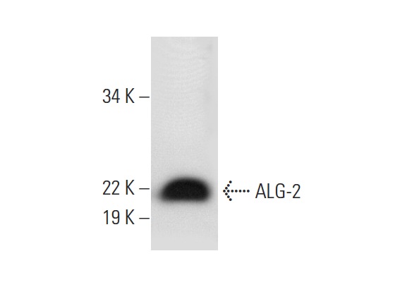  ALG-2 (H-11): sc-376950. Western blot analysis of ALG-2 expression in HeLa whole cell lysate.