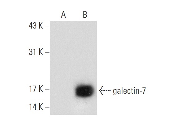  galectin-7 (D-5): sc-137086. Western blot analysis of galectin-7 expression in non-transfected: sc-117752 (A) and human galectin-7 transfected: sc-117240 (B) 293T whole cell lysates.