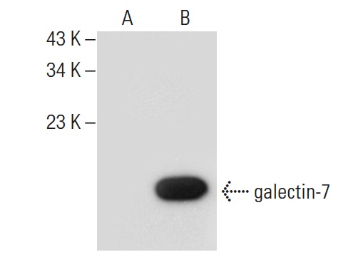  galectin-7 (D-5): sc-137086. Western blot analysis of galectin-7 expression in non-transfected: sc-117752 (A) and human galectin-7 transfected: sc-117240 (B) 293T whole cell lysates.