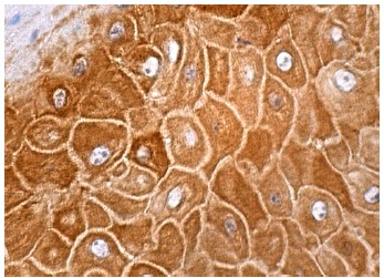  galectin-7 (D-5): sc-137086. Immunoperoxidase staining of formalin fixed, paraffin-embedded human oral mucosa tissue showing cytoplasmic staining of squamous epithelial cells.