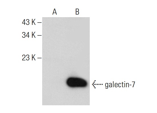  galectin-7 (G-3): sc-137085. Western blot analysis of galectin-7 expression in non-transfected: sc-117752 (A) and human galectin-7 transfected: sc-117240 (B) 293T whole cell lysates.