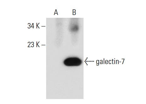  galectin-7 (A-8): sc-271473. Western blot analysis of galectin-7 expression in non-transfected: sc-117752 (A) and human galectin-7 transfected: sc-117240 (B) 293T whole cell lysates.